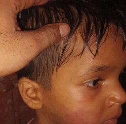 'पापा बुला रहे हैं...'  कहकर बच्चे को ले गया अज्ञात व्यक्ति,  मिला तो ये था हाल