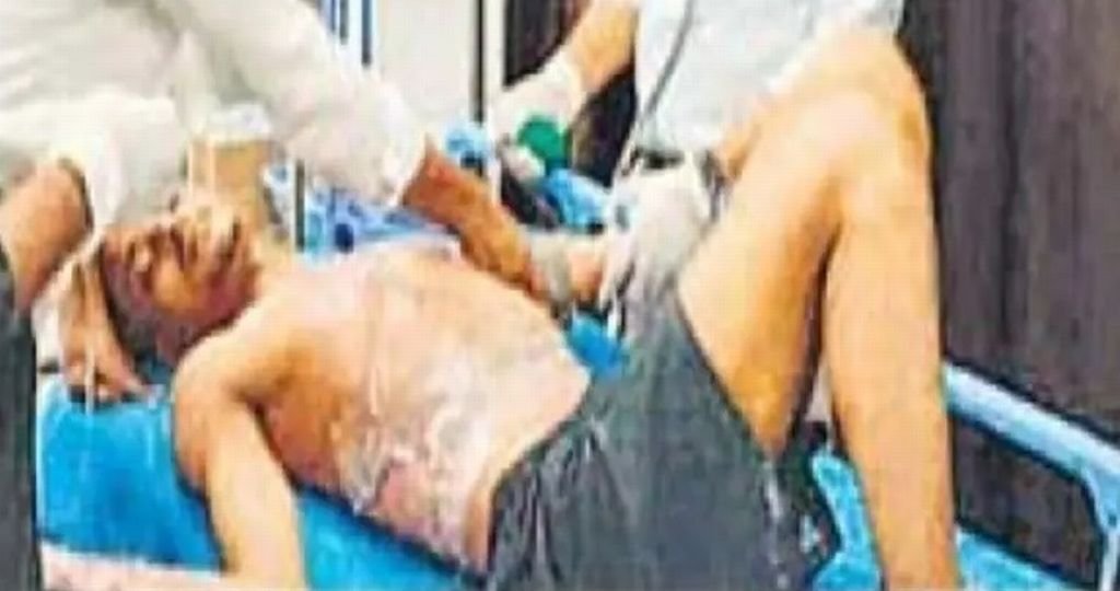 पत्नी से चल रहा था विवाद....बेटा घर आया तो पिता ने पेट्रोल छिड़ककर लगा दी आग