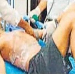 पत्नी से चल रहा था विवाद....बेटा घर आया तो पिता ने पेट्रोल छिड़ककर लगा दी आग
