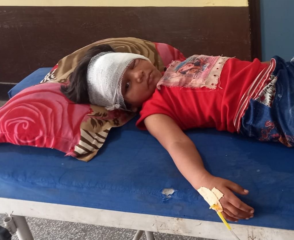 छत पर सो रहीं थीं दो बालिकाएं, अचानक आ गया बंदरों का झुंड...फिर हुआ ये