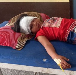 छत पर सो रहीं थीं दो बालिकाएं, अचानक आ गया बंदरों का झुंड...फिर हुआ ये