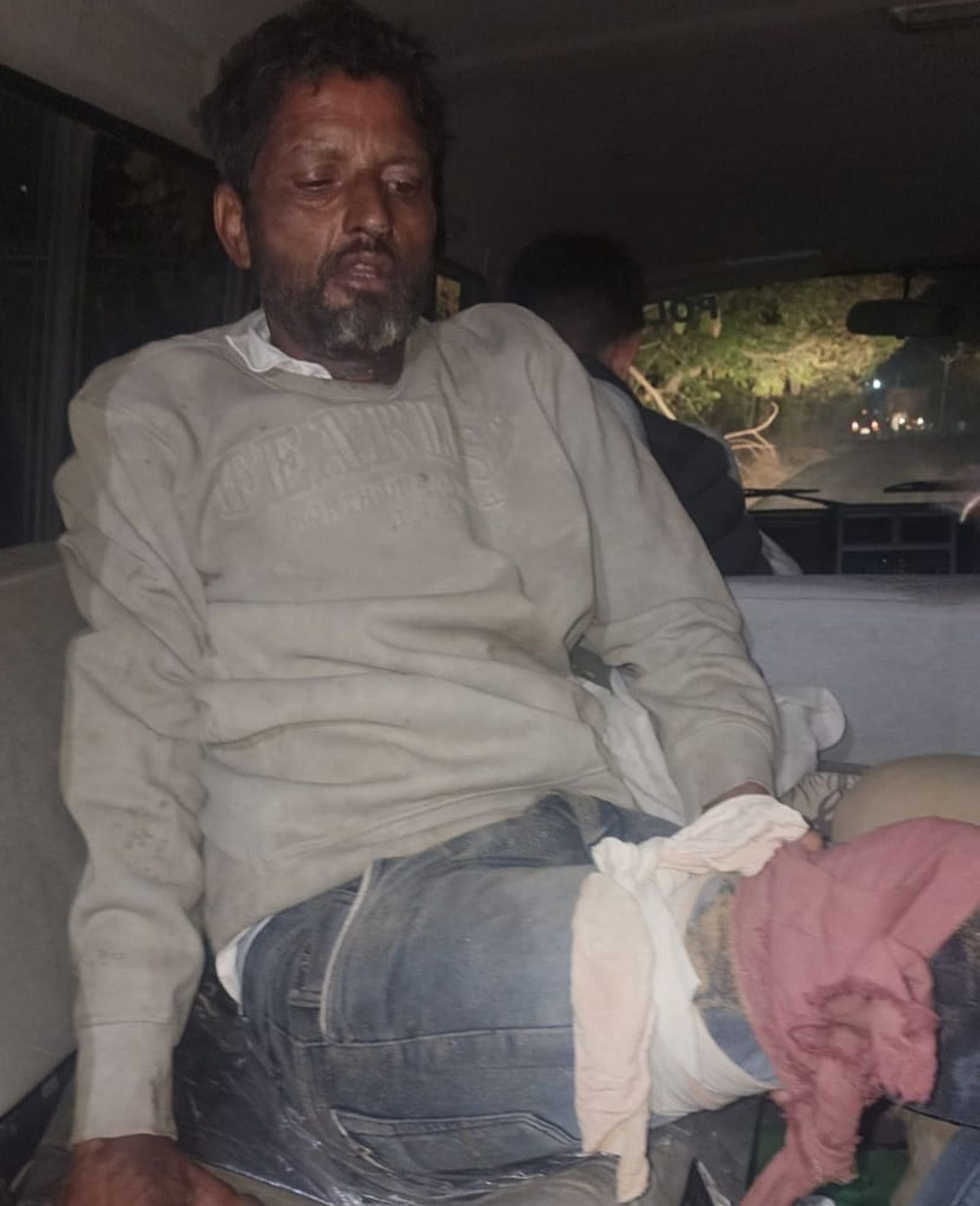 अपने ' पैरों पर खड़ा' होकर बदमाश अस्पताल से हुआ फुर्र...मुठभेड़ में लगी थी गोली