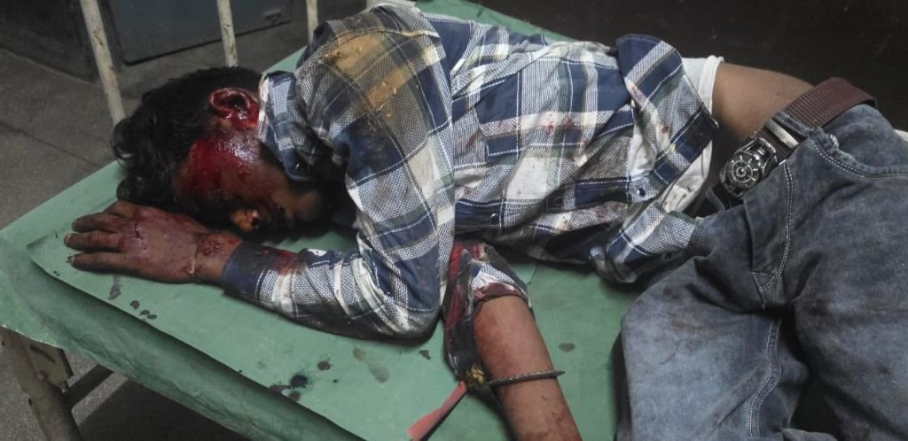 बाइक से भाग रहा था प्रेमी युगल... अधेड़ से टक्कर हुई तो डेढ़ सौ मीटर तक घसीट ले गया