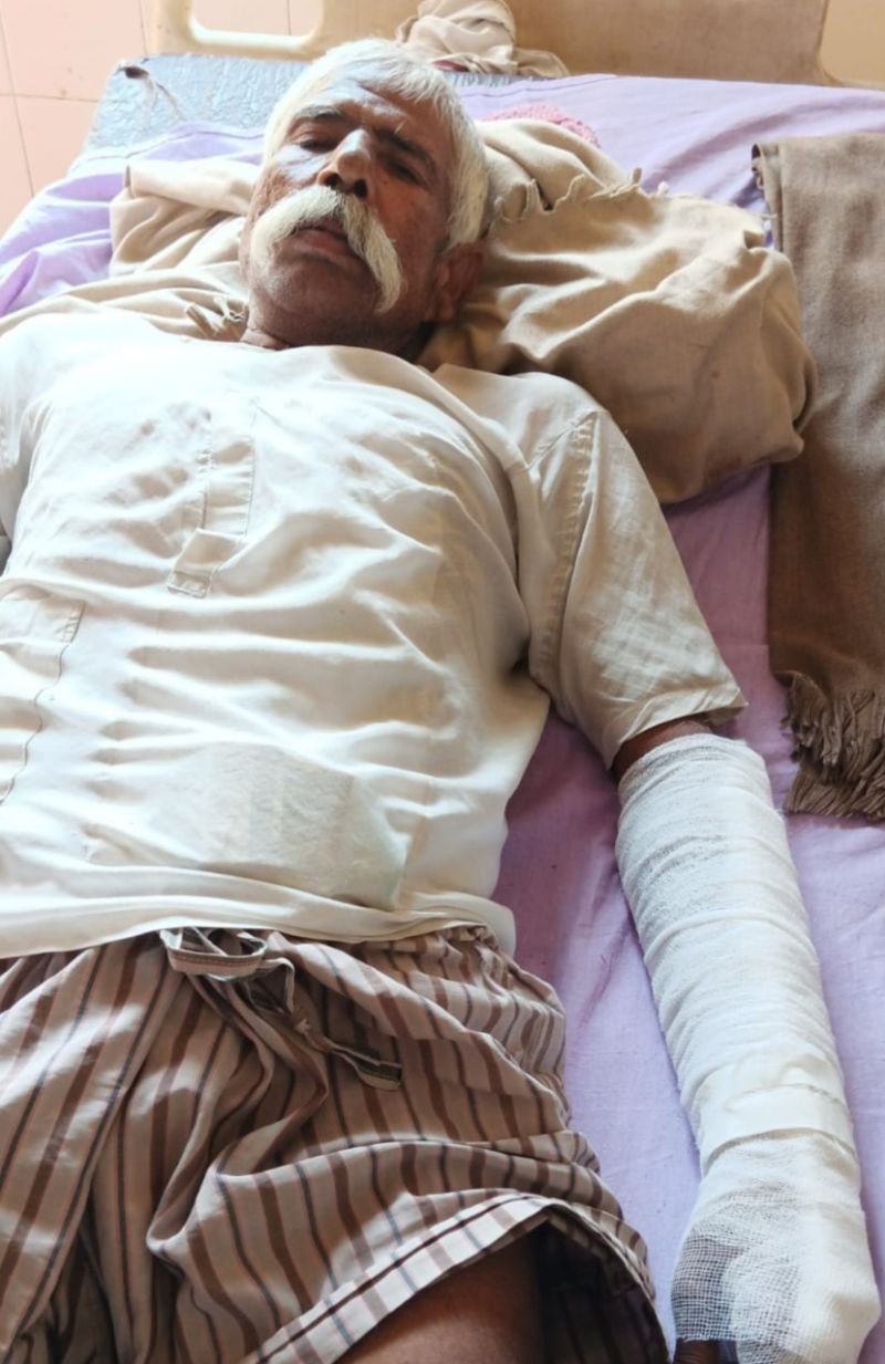 दिवाली पर हुई गाली गलौज....सोते समय पिटाई कर हाथ पैर तोड़ डाले