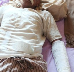 दिवाली पर हुई गाली गलौज....सोते समय पिटाई कर हाथ पैर तोड़ डाले