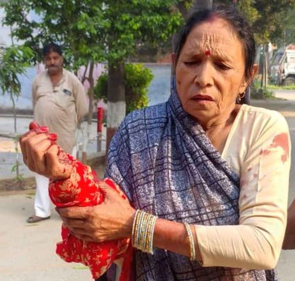 गाली देने से मना किया तो घर में घुसा सिरफिरा, फरसा लेकर ताबड़तोड़ कर दिए वार