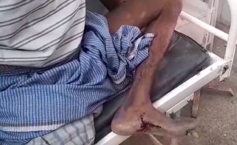 इस गांव में मचा भेड़िये का शोर....निकला सियार, बच्चे समेत तीन को काटकर किया जख्मी