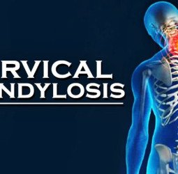 ज्यादा देर तक बैठते हैं कंप्यूटर के सामने या चलाते हैं मोबाइल तो हो हो सकता है सर्वाइकल पेन